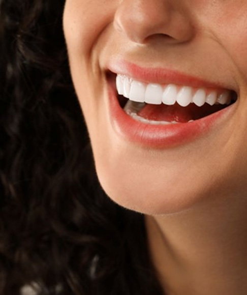 Close-up of woman’s smile with beautiful teeth