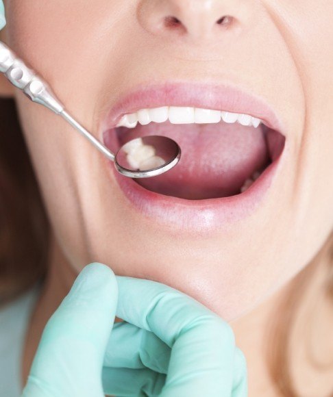 Smile examined after metal free dental restoration treatment