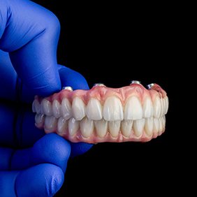 an example of all-on-4 dentures in Vero Beach