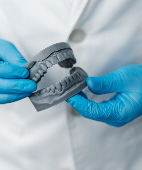 3D printed denture 