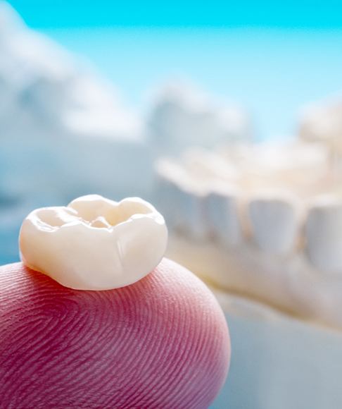 a person holding a Same-Day Zirconia crown in Vero Beach