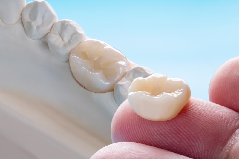 example of a dental crown