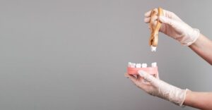 Gloved hands using model to demonstrate tooth extraction 